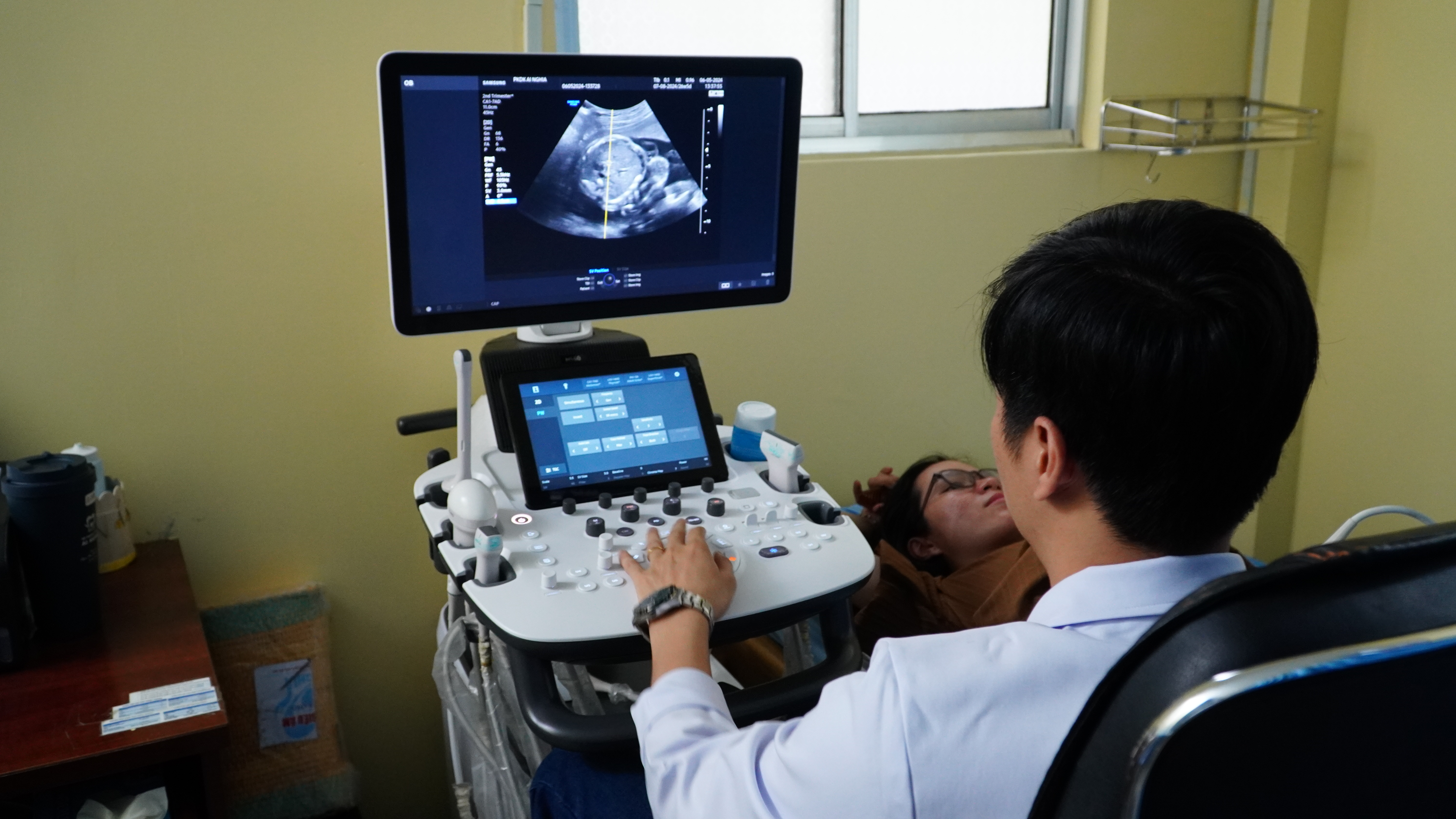 Hệ thống máy siêu âm hiện đại