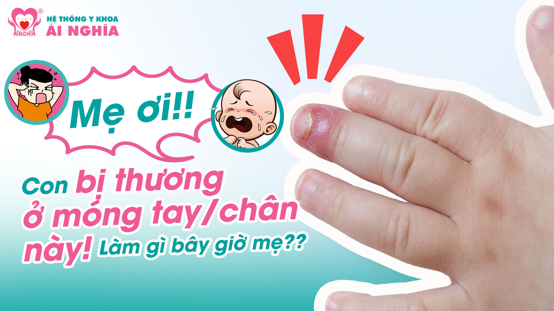 Mẹ ơi, con bị thương ở móng tay/chân! Làm gì bây giờ?