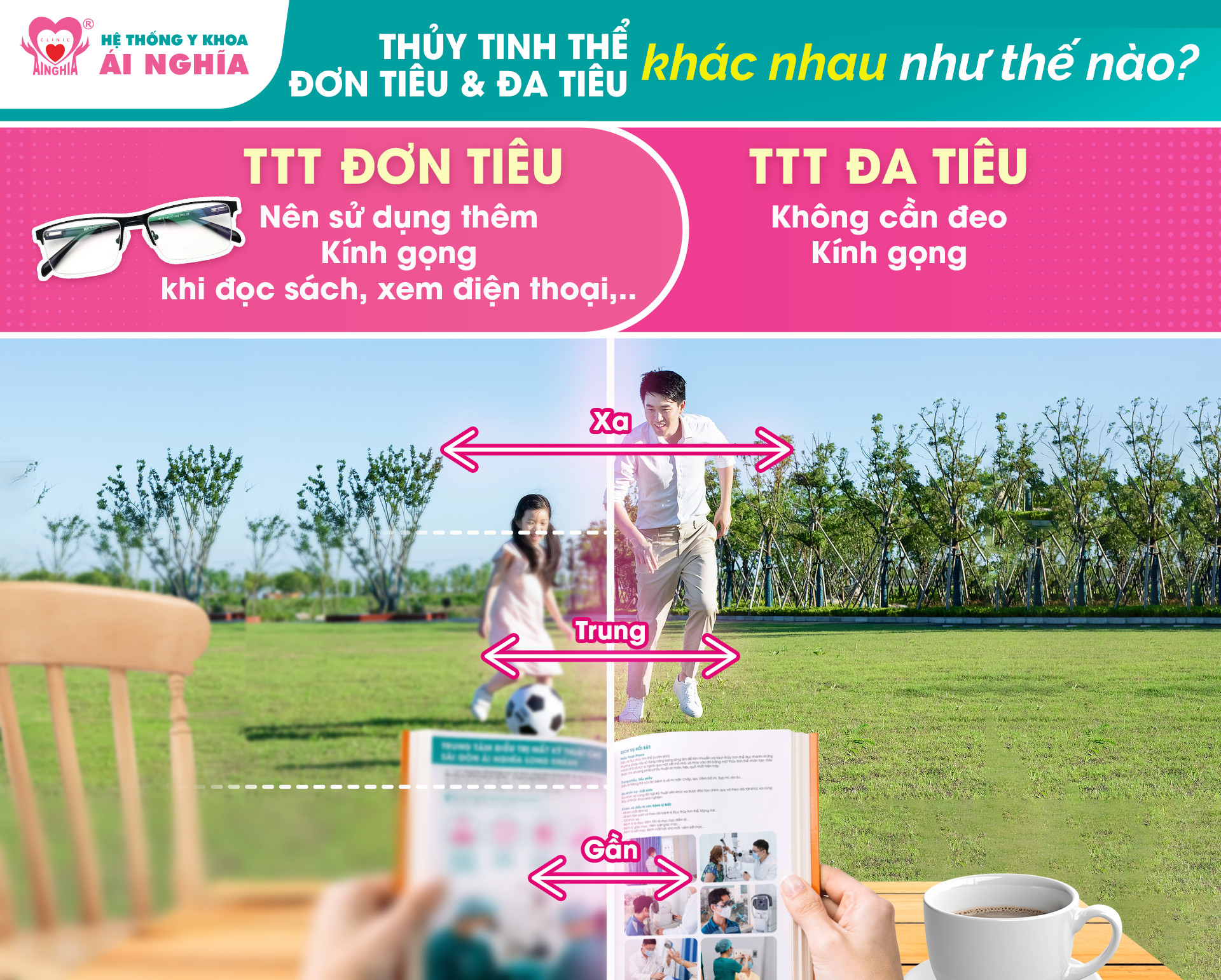 Thủy tinh thể đơn tiêu và đa tiêu khác nhau như thế nào?