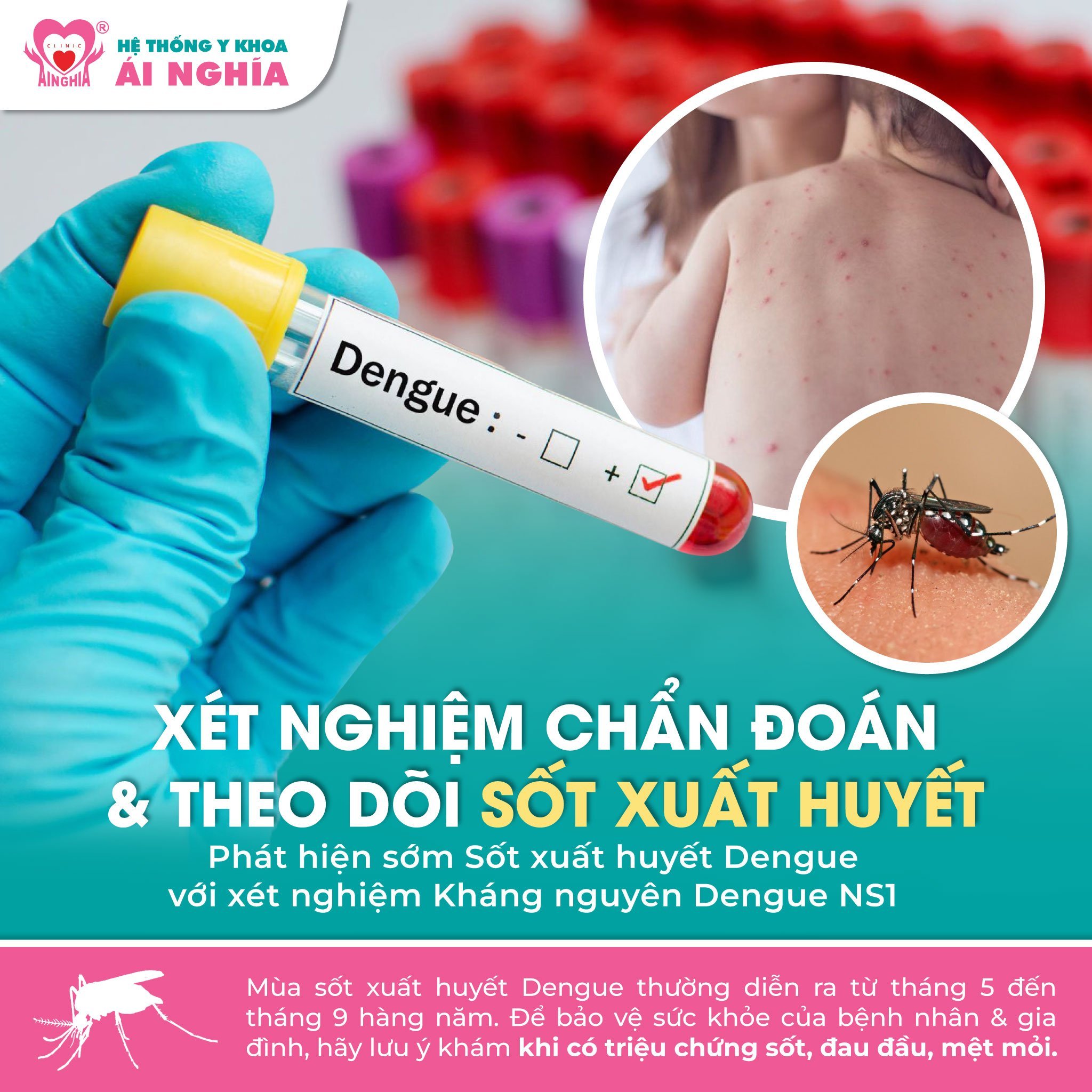 Phát hiện sớm sốt xuất huyết Dengue với xét nghiệm Kháng nguyên Dengue NS1