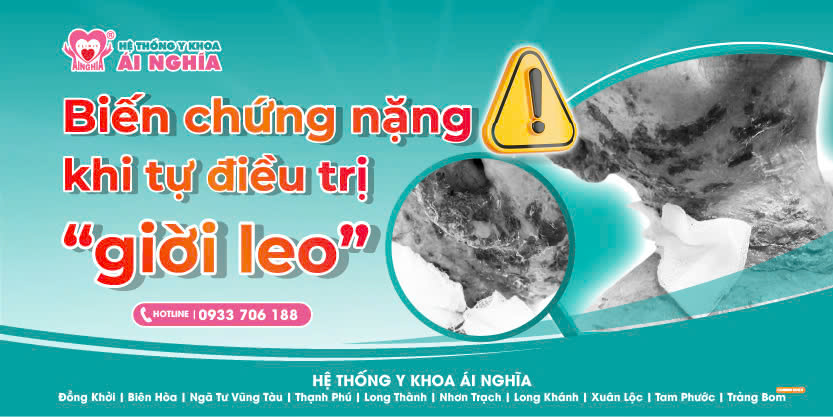 Biến chứng nặng khi tự điều trị Giời leo (Zona)